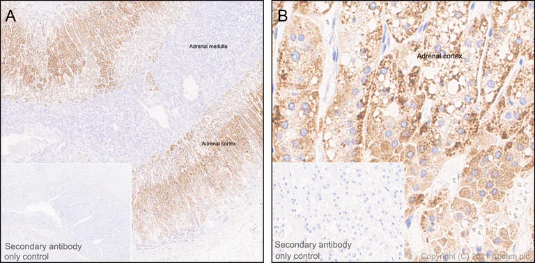 Immunohistochemistry (Formalin/PFA-fixed paraffin-embedded sections) - Anti-CYP11A1 antibody [EPR24868-86] - BSA and Azide free (AB288573)