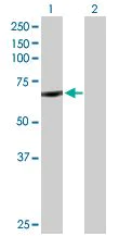 Western blot - Anti-CYP11B1 antibody (AB171888)