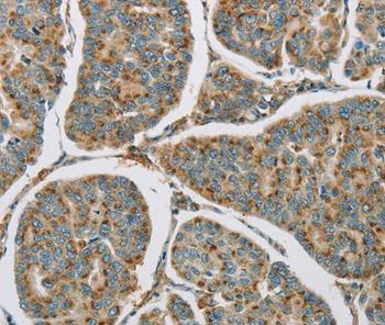 Immunohistochemistry (Formalin/PFA-fixed paraffin-embedded sections) - Anti-CYP11B1 antibody (AB197908)