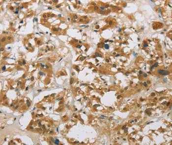 Immunohistochemistry (Formalin/PFA-fixed paraffin-embedded sections) - Anti-CYP11B1 antibody (AB197908)