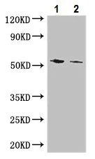 Western blot - Anti-CYP11B1 antibody (AB229884)