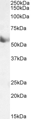 Western blot - Anti-CYP1A1 antibody (AB126887), expandable thumbnail