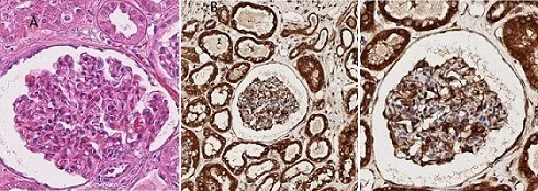 Immunohistochemistry (Formalin/PFA-fixed paraffin-embedded sections) - Anti-CYP1A1 antibody (AB235185)