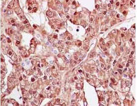 Anti-CYP1B1 antibody [EPR14972] - C-terminal (ab185954) | Abcam
