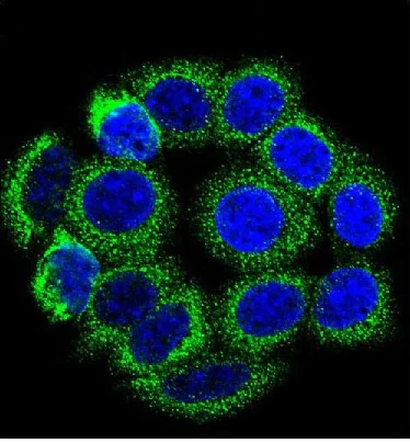 Immunocytochemistry/ Immunofluorescence - Anti-CYP21A2 antibody (AB230327)