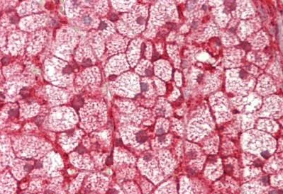 Immunohistochemistry (Formalin/PFA-fixed paraffin-embedded sections) - Anti-CYP21A2 antibody (AB230327)
