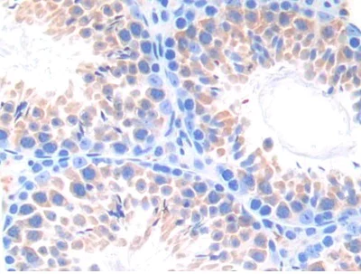 Immunohistochemistry (Formalin/PFA-fixed paraffin-embedded sections) - Anti-CYP21A2 antibody (AB232701)