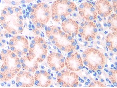 Immunohistochemistry (Formalin/PFA-fixed paraffin-embedded sections) - Anti-CYP21A2 antibody (AB232701)