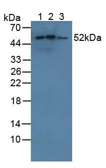 Western blot - Anti-CYP21A2 antibody (AB232701)