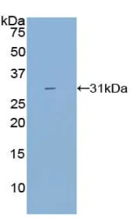 Western blot - Anti-CYP21A2 antibody (AB232701)