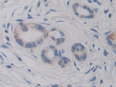 Immunohistochemistry (Formalin/PFA-fixed paraffin-embedded sections) - Anti-CYP21A2 antibody (ab232809), expandable thumbnail