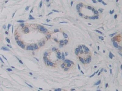 Immunohistochemistry (Formalin/PFA-fixed paraffin-embedded sections) - Anti-CYP21A2 antibody (AB232809)