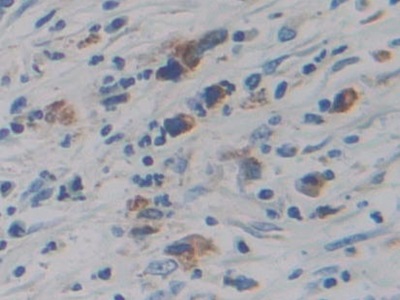 Immunohistochemistry (Formalin/PFA-fixed paraffin-embedded sections) - Anti-CYP21A2 antibody (AB232809), expandable thumbnail