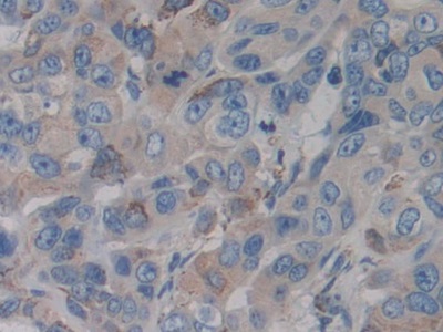 Immunohistochemistry (Formalin/PFA-fixed paraffin-embedded sections) - Anti-CYP21A2 antibody (AB232809), expandable thumbnail