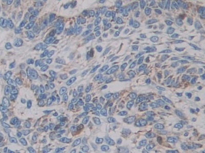 Immunohistochemistry (Formalin/PFA-fixed paraffin-embedded sections) - Anti-CYP21A2 antibody (AB232809), expandable thumbnail