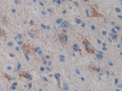 Immunohistochemistry (Formalin/PFA-fixed paraffin-embedded sections) - Anti-CYP21A2 antibody (AB232809), expandable thumbnail