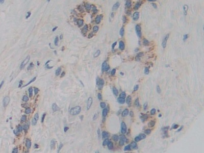 Immunohistochemistry (Formalin/PFA-fixed paraffin-embedded sections) - Anti-CYP21A2 antibody (AB232809), expandable thumbnail