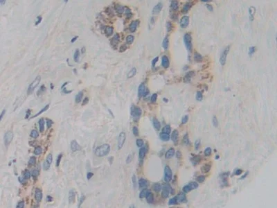 Immunohistochemistry (Formalin/PFA-fixed paraffin-embedded sections) - Anti-CYP21A2 antibody (AB232809)