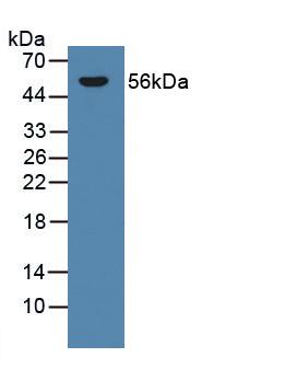 Western blot - Anti-CYP21A2 antibody (ab232809), expandable thumbnail