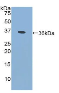 Western blot - Anti-CYP21A2 antibody (AB232809)