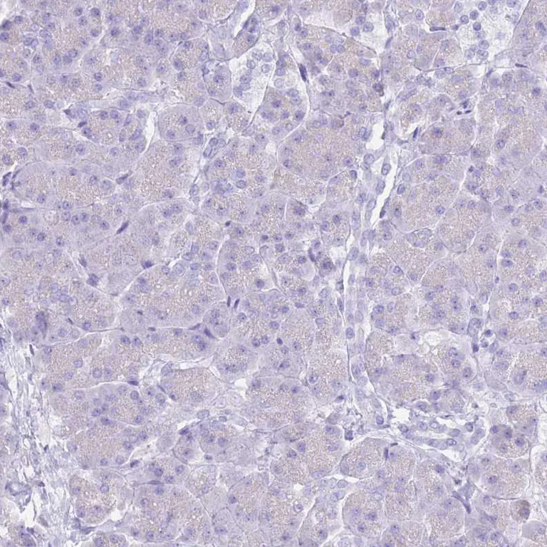 Immunohistochemistry (Formalin/PFA-fixed paraffin-embedded sections) - Anti-CYP21A2 antibody (AB247085)
