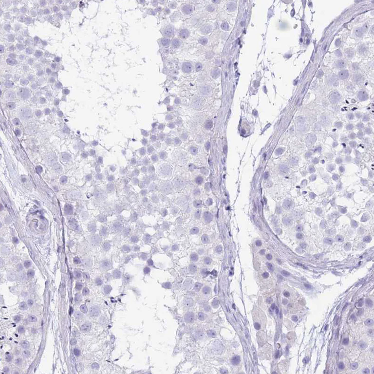 Immunohistochemistry (Formalin/PFA-fixed paraffin-embedded sections) - Anti-CYP21A2 antibody (AB247085)