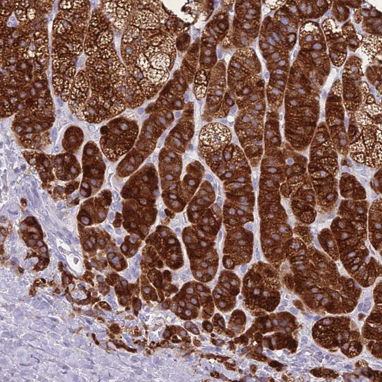 Immunohistochemistry (Formalin/PFA-fixed paraffin-embedded sections) - Anti-CYP21A2 antibody (AB247085)