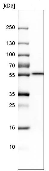 Western blot - Anti-CYP21A2 antibody (AB247085)