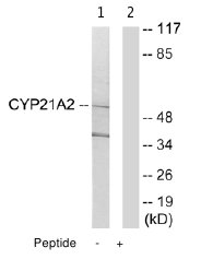 Western blot - Anti-CYP21A2 antibody (AB64887), expandable thumbnail