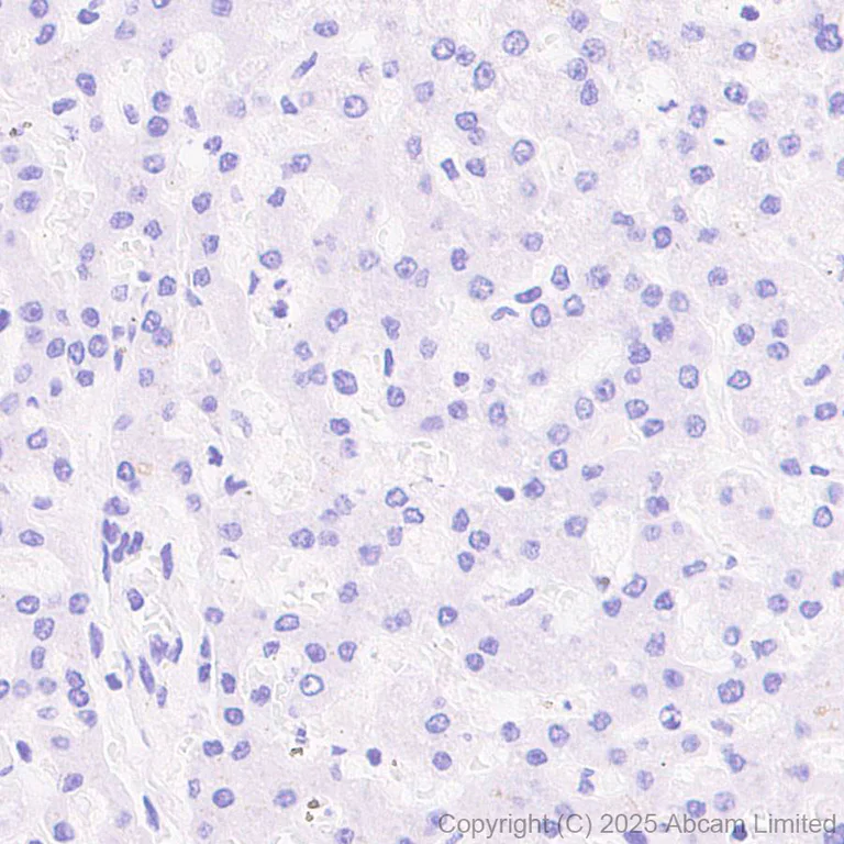 Immunohistochemistry (Formalin/PFA-fixed paraffin-embedded sections) - Anti-CYP21A2 antibody [EPR29787-27] (AB324019)