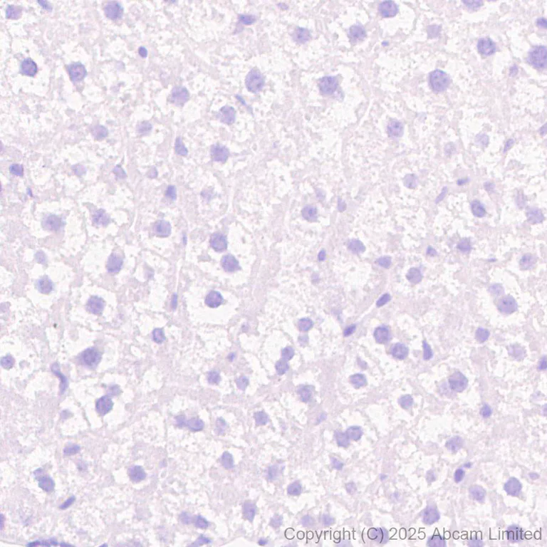 Immunohistochemistry (Formalin/PFA-fixed paraffin-embedded sections) - Anti-CYP21A2 antibody [EPR29787-27] (AB324019)
