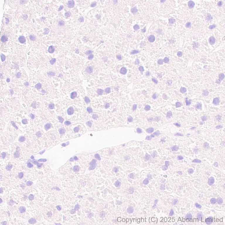 Immunohistochemistry (Formalin/PFA-fixed paraffin-embedded sections) - Anti-CYP21A2 antibody [EPR29787-27] (AB324019)