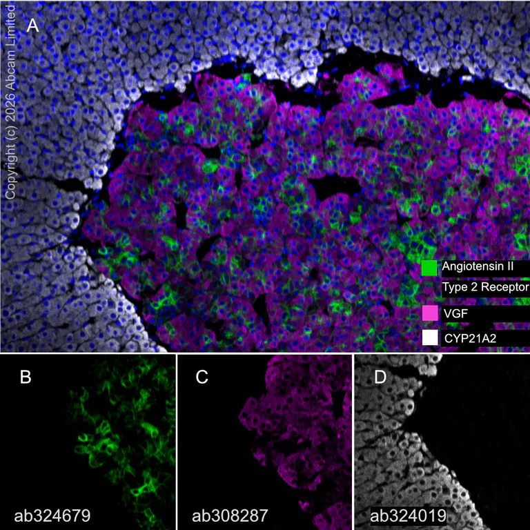 Multiplex immunohistochemistry - Anti-CYP21A2 antibody [EPR29787-27] (AB324019)