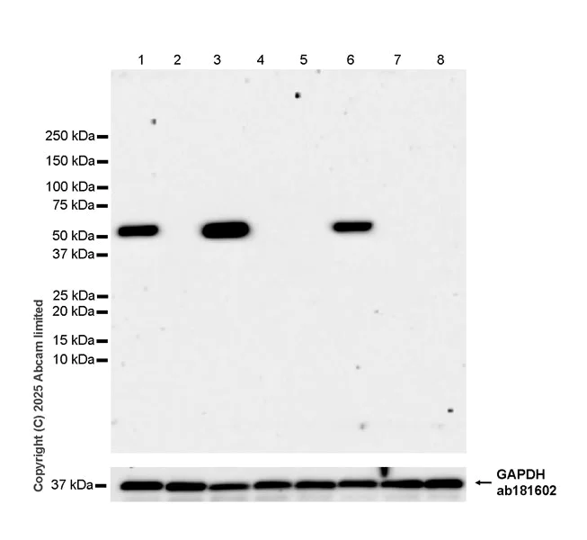 Western blot - Anti-CYP21A2 antibody [EPR29787-27] (AB324019)