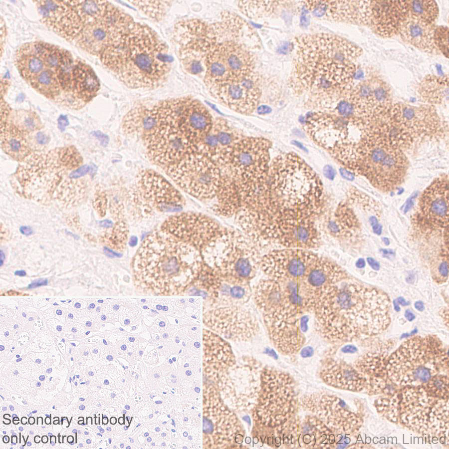Immunohistochemistry (Formalin/PFA-fixed paraffin-embedded sections) - Anti-CYP21A2 antibody [EPR29787-27]  - BSA and Azide free (AB324020), expandable thumbnail