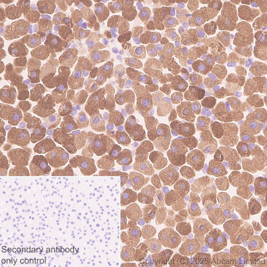 Immunohistochemistry (Formalin/PFA-fixed paraffin-embedded sections) - Anti-CYP21A2 antibody [EPR29787-27]  - BSA and Azide free (AB324020), expandable thumbnail