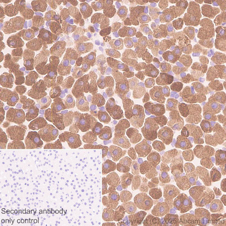 Immunohistochemistry (Formalin/PFA-fixed paraffin-embedded sections) - Anti-CYP21A2 antibody [EPR29787-27] - BSA and Azide free (AB324020)