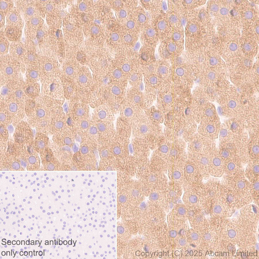 Immunohistochemistry (Formalin/PFA-fixed paraffin-embedded sections) - Anti-CYP21A2 antibody [EPR29787-27]  - BSA and Azide free (AB324020), expandable thumbnail