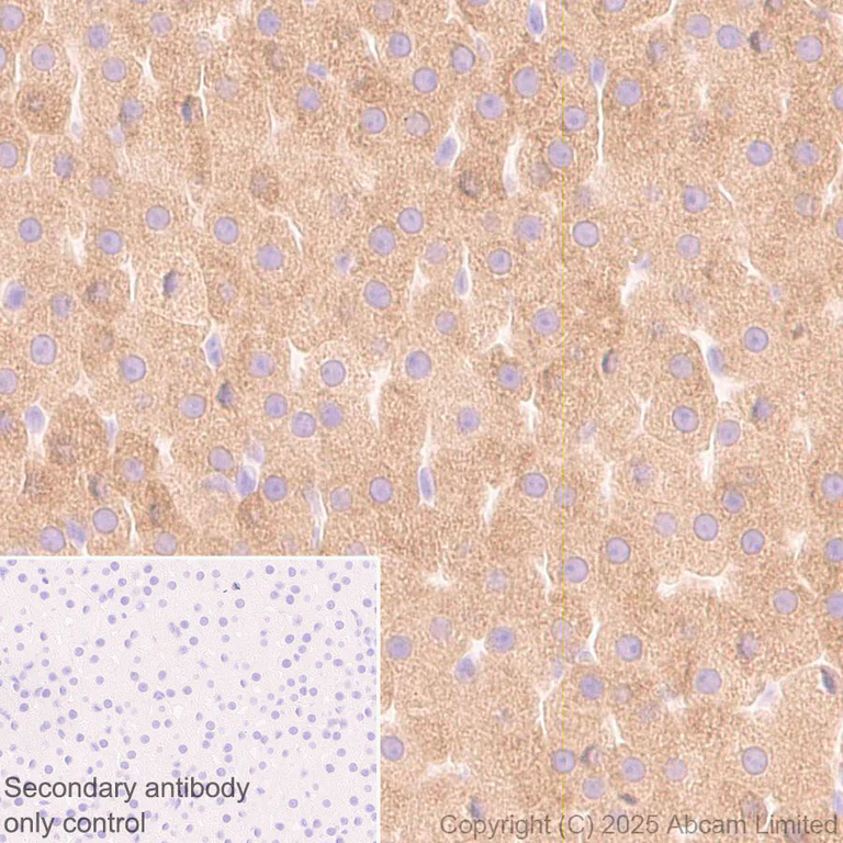 Immunohistochemistry (Formalin/PFA-fixed paraffin-embedded sections) - Anti-CYP21A2 antibody [EPR29787-27] - BSA and Azide free (AB324020)