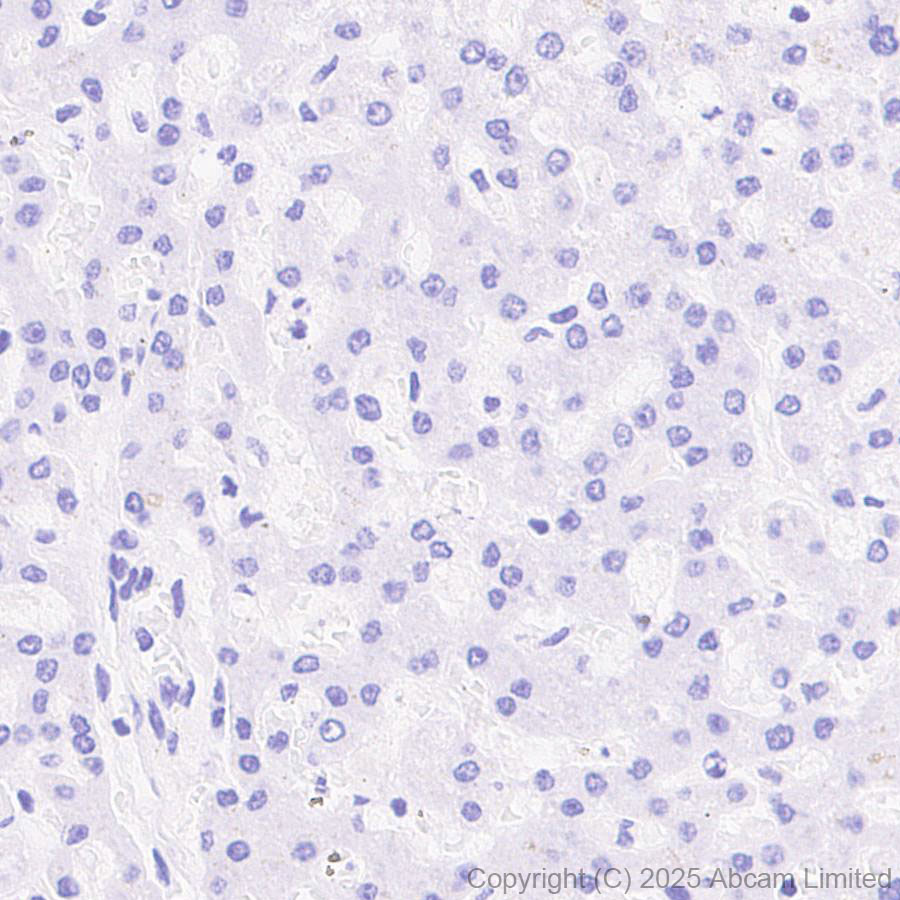 Immunohistochemistry (Formalin/PFA-fixed paraffin-embedded sections) - Anti-CYP21A2 antibody [EPR29787-27]  - BSA and Azide free (AB324020), expandable thumbnail