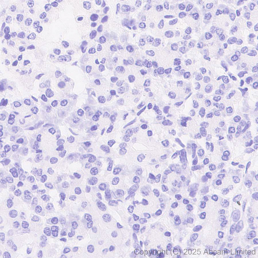 Immunohistochemistry (Formalin/PFA-fixed paraffin-embedded sections) - Anti-CYP21A2 antibody [EPR29787-27]  - BSA and Azide free (ab324020), expandable thumbnail