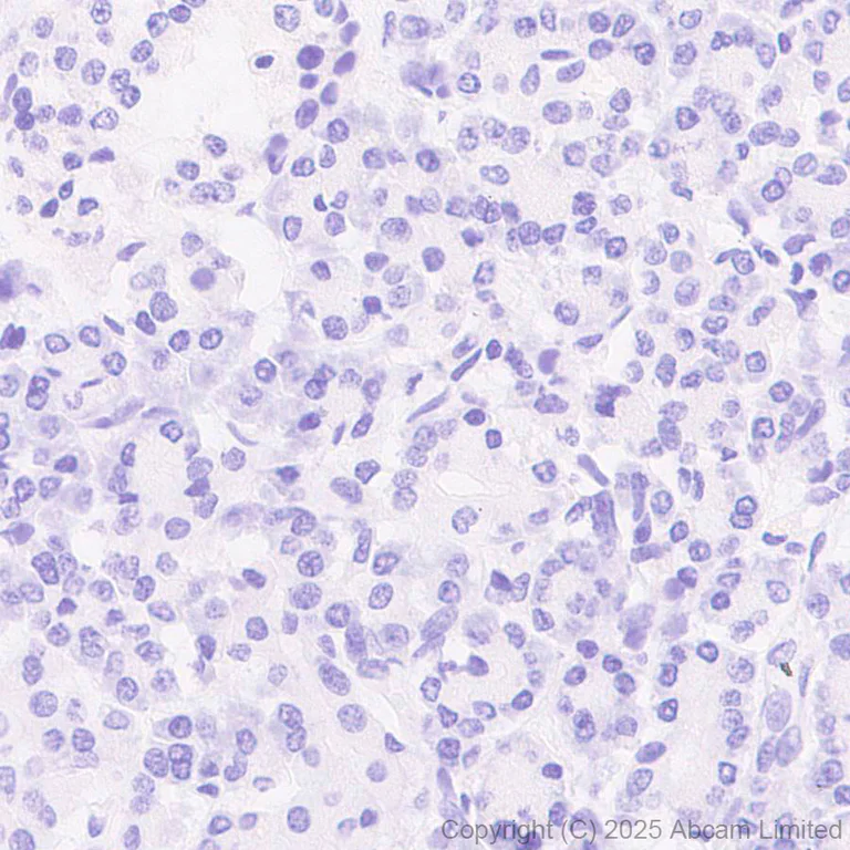 Immunohistochemistry (Formalin/PFA-fixed paraffin-embedded sections) - Anti-CYP21A2 antibody [EPR29787-27] - BSA and Azide free (AB324020)