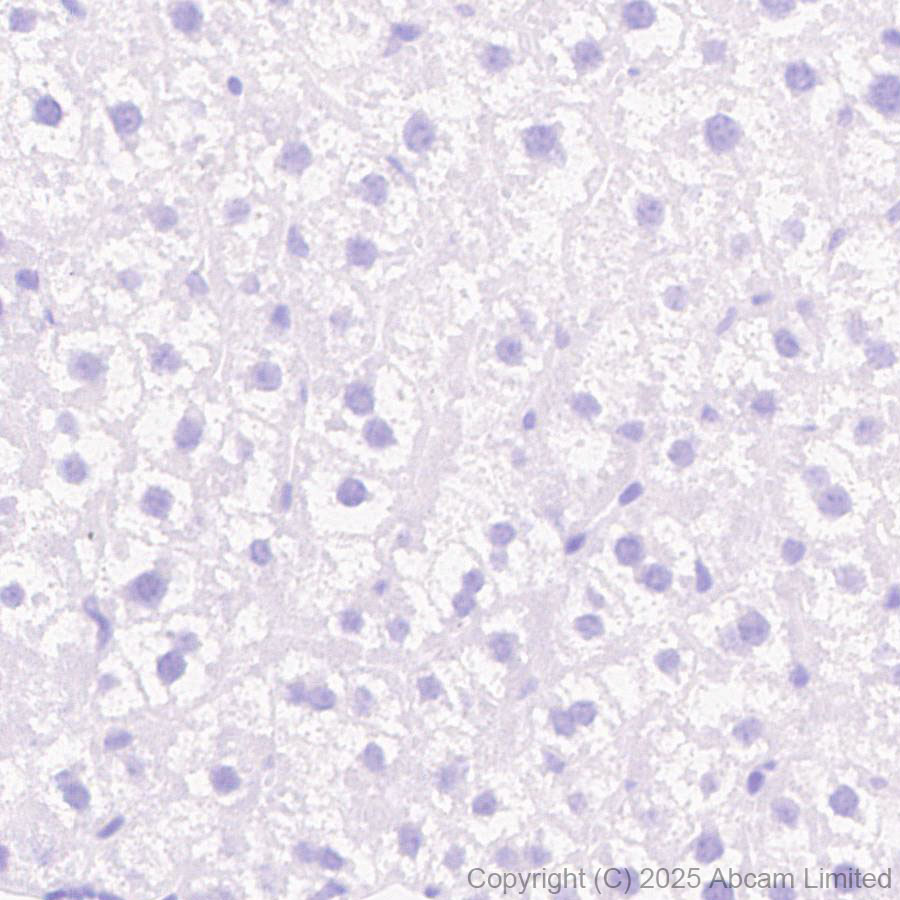 Immunohistochemistry (Formalin/PFA-fixed paraffin-embedded sections) - Anti-CYP21A2 antibody [EPR29787-27]  - BSA and Azide free (ab324020), expandable thumbnail