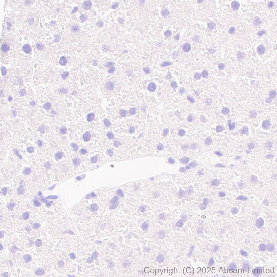 Immunohistochemistry (Formalin/PFA-fixed paraffin-embedded sections) - Anti-CYP21A2 antibody [EPR29787-27]  - BSA and Azide free (ab324020), expandable thumbnail