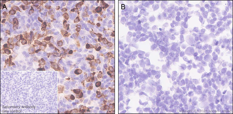 Immunohistochemistry (Formalin/PFA-fixed paraffin-embedded sections) - Anti-CYP21A2 antibody [EPR29787-27] - BSA and Azide free (AB324020)