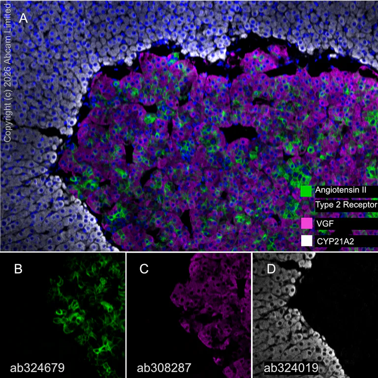 Multiplex immunohistochemistry - Anti-CYP21A2 antibody [EPR29787-27] - BSA and Azide free (AB324020)