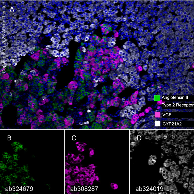 Multiplex immunohistochemistry - Anti-CYP21A2 antibody [EPR29787-27] - BSA and Azide free (AB324020)