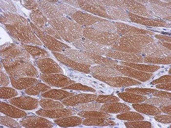 Immunohistochemistry (Formalin/PFA-fixed paraffin-embedded sections) - Anti-CYP26A1 antibody (AB151968), expandable thumbnail