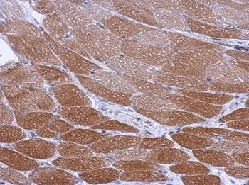 Immunohistochemistry (Formalin/PFA-fixed paraffin-embedded sections) - Anti-CYP26A1 antibody (AB151968)