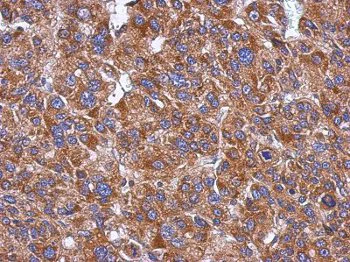Immunohistochemistry (Formalin/PFA-fixed paraffin-embedded sections) - Anti-CYP26A1 antibody (AB151968)